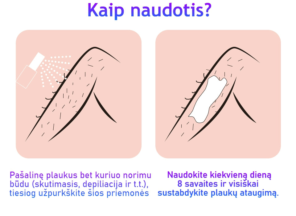 Plaukų-augimą-stabdantis-purškiklis
